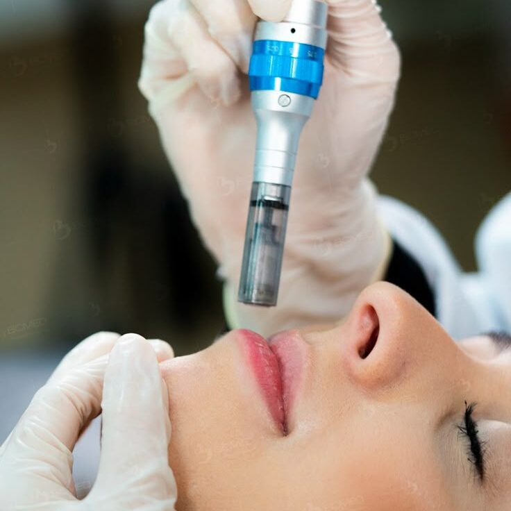 dermapen