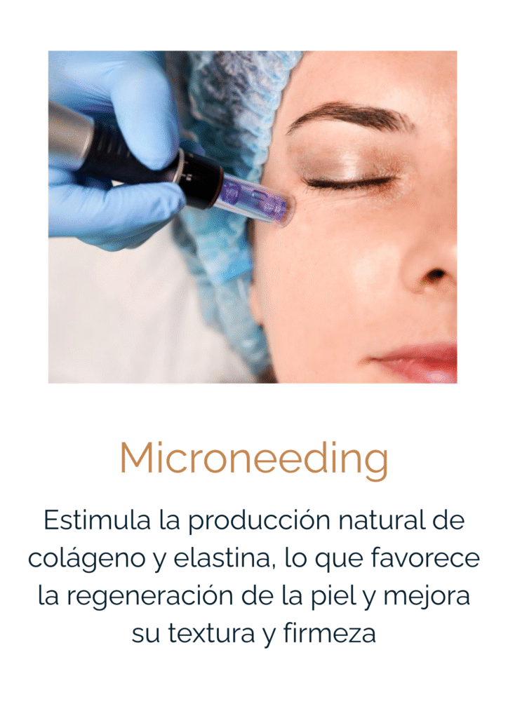 microneenfing
